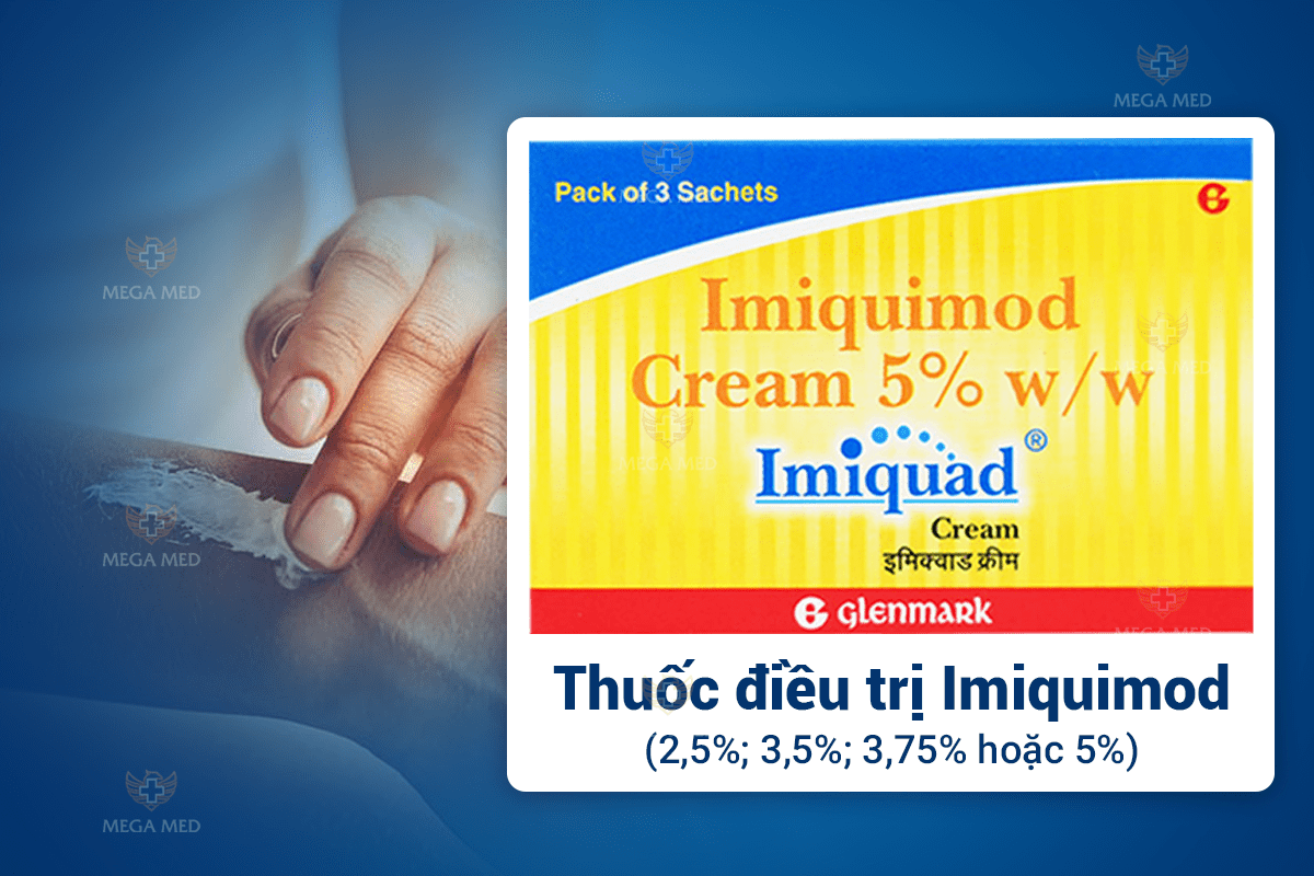 Trị sùi mào gà bằng thuốc tây